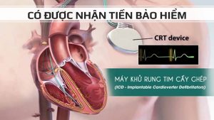 Hội chứng Brugada bảo hiểm