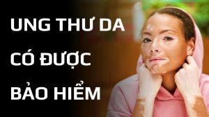 Ung thư da có được bảo hiểm