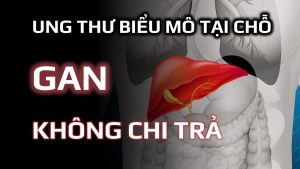 Bảo hiểm bệnh ung thư biểu mô tại chỗ